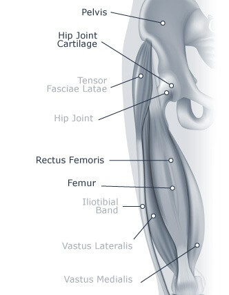 Hip Pain Diagram 2