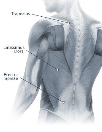 Spine (Neck & Back Pain) Diagram
